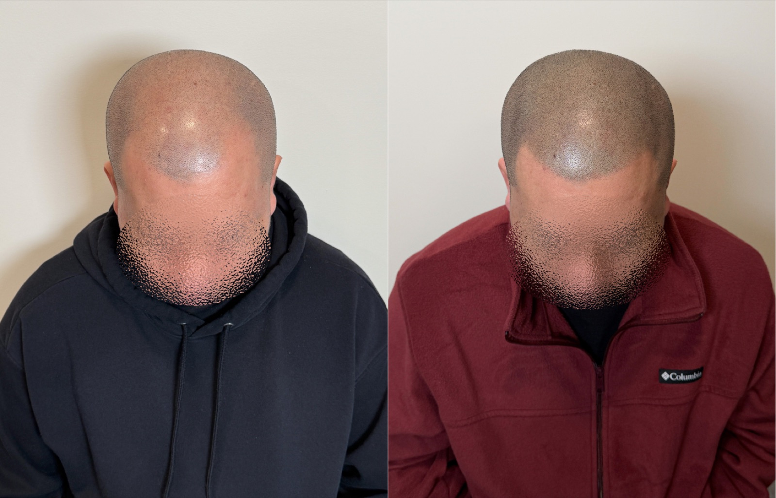Shaved look SMP portfolio 23